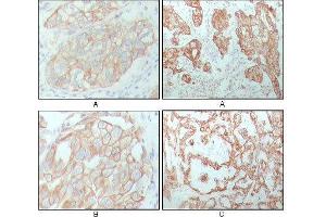 Immunohistochemistry (IHC) image for anti-Keratin 8 (KRT8) (AA 391-483) antibody (ABIN969080)