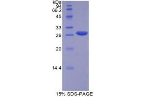 SDS-PAGE (SDS) image for Runt-Related Transcription Factor 2 (RUNX2) (AA 299-521) protein (His tag) (ABIN1879698) (RUNX2 Protein (AA 299-521) (His tag))