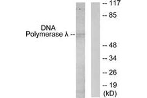 Western blot analysis of extracts from 293 cells, using DNA Polymerase lambda Antibody. (POLL Antikörper  (AA 451-500))