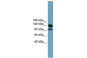 WB Suggested Anti-LRRC66 Antibody Titration:  0. (LRRC66 Antikörper  (Middle Region))