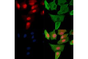 Phospho-Foxp3 (Ser19) Antibody staining A549 cells(H2O2 treatment) by IF/ICC. (FOXP3 Antikörper  (pSer19))