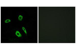 Immunofluorescence analysis of LOVO cells, using EDG7 antibody. (LPAR3 Antikörper  (Internal Region))