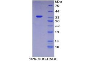 SDS-PAGE analysis of Mouse MRC1 Protein. (Macrophage Mannose Receptor 1 Protein)