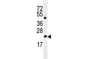Bax antibody western blot analysis in HL-60 lysate (BAX Antikörper  (AA 41-76))