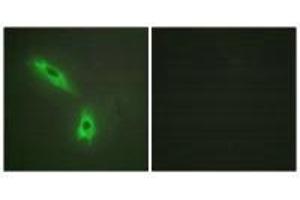Immunofluorescence analysis of HeLa cells, using TNFC antibody.