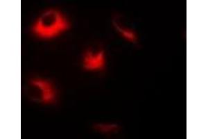 Immunofluorescent analysis of Dopamine Receptor D5 staining in Hela cells. (DRD5 Antikörper)