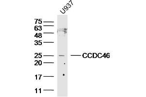 Lane 1: U937 lysates probed with CCDC46 Polyclonal Antibody, Unconjugated  at 1:300 overnight at 4˚C. (CCDC46 Antikörper  (AA 751-850))