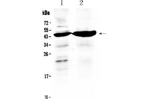 Western blot analysis of TFPI using anti- TFPI antibody .