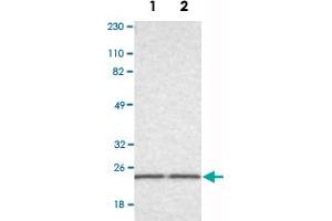 Western Blot analysis of Lane 1: RT-4 and Lane 2: U-251MG sp cell lysates with RAB13 polyclonal antibody . (RAB13 Antikörper)