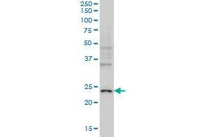 Neurogenin 1 anticorps  (AA 82-163)