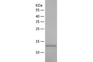 Western Blotting (WB) image for Thiosulfate Sulfurtransferase (Rhodanese)-Like Domain Containing 1 (TSTD1) (AA 1-115) protein (His tag) (ABIN7125371) (TSTD1 Protein (AA 1-115) (His tag))