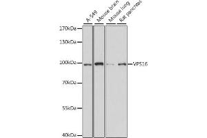 Western blot analysis of extracts of various cell lines, using VPS16 antibody (ABIN7271281) at 1:1000 dilution. (VPS16 Antikörper  (AA 540-839))