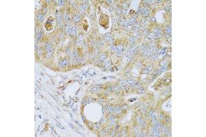 Immunohistochemistry (Paraffin-embedded Sections) (IHC (p)) image for anti-Pregnancy Specific beta-1-Glycoprotein 1 (PSG1) (AA 180-419) antibody (ABIN6146294)