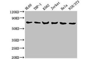 Western Blot Positive WB detected in: HL60 whole cell lysate, THP-1 whole cell lysate, K562 whole cell lysate, Jurkat whole cell lysate, Hela whole cell lysate, NIH/3T3 whole cell lysate All lanes: LCP1 antibody at 8 μg/mL Secondary Goat polyclonal to rabbit IgG at 1/10000 dilution Predicted band size: 71, 22 kDa Observed band size: 71 kDa (LCP1 Antikörper  (AA 2-627))