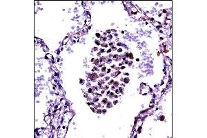 NFKBIB Antibody (C-term) ((ABIN657702 and ABIN2846693))immunohistochemistry analysis in formalin fixed and paraffin embedded human lung tissue followed by peroxidase conjugation of the secondary antibody and DAB staining. (NFKBIB Antikörper  (C-Term))