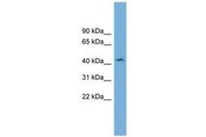 Image no. 1 for anti-UDP-Gal:betaGlcNAc beta 1,4- Galactosyltransferase, Polypeptide 3 (B4GALT3) (AA 71-120) antibody (ABIN6744806)