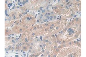 IHC-P analysis of Mouse Kidney Tissue, with DAB staining. (CPB1 Antikörper  (AA 109-415))