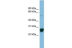 WB Suggested Anti-RPL10A Antibody Titration: 0. (RPL10A Antikörper  (N-Term))