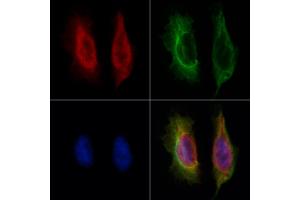 ABIN6265329 and ABIN6273169 staining Hela by IF/ICC.