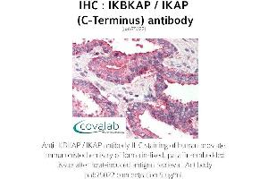 Image no. 2 for anti-Elongator Complex Protein 1 (ELP1) antibody (ABIN1735852) (IKAP/p150 Antikörper)
