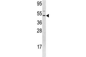 Western blot analysis of FLI1 antibody and 293 lysate. (FLI1 Antikörper  (AA 52-80))