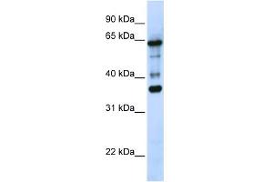 WB Suggested Anti-ZNF630 Antibody Titration:  0. (ZNF630 Antikörper  (N-Term))
