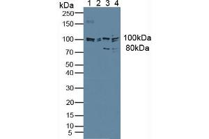 Figure. (JAG1 Antikörper  (AA 836-1047))