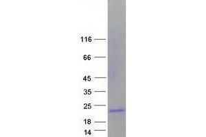 Validation with Western Blot
