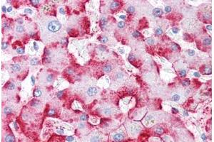 Human Liver (formalin-fixed, paraffin-embedded) stained with C4BPA antibody ABIN334259 at 5 ug/ml followed by biotinylated anti-mouse IgG secondary antibody ABIN481714, alkaline phosphatase-streptavidin and chromogen. (C4BP Antikörper)