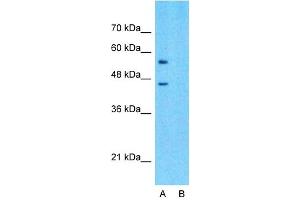 Host:  Rabbit  Target Name:  SLC15A4  Sample Type:  293T  Lane A:  Primary Antibody  Lane B:  Primary Antibody + Blocking Peptide  Primary Antibody Concentration:  1ug/ml  Peptide Concentration:  5ug/ml  Lysate Quantity:  25ug/lane/lane  Gel Concentration:  0. (SLC15A4 Antikörper  (Middle Region))