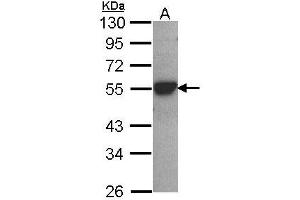Image no. 2 for anti-Cytochrome P450, Family 2, Subfamily D, Polypeptide 6 (CYP2D6) (AA 268-457) antibody (ABIN467616) (CYP2D6 Antikörper  (AA 268-457))