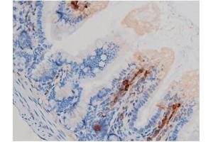 ABIN6267438 at 1/200 staining Mouse intestinal tissue sections by IHC-P. (RPS6KB1 Antikörper  (pSer371))