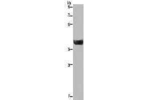 Western Blotting (WB) image for anti-Hydroxysteroid (17-Beta) Dehydrogenase 2 (HSD17B2) antibody (ABIN2423607) (HSD17B2 Antikörper)