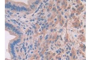 Immunohistochemistry (IHC) image for anti-Myosin Light Chain Kinase 2 (MYLK2) (AA 330-548) antibody (ABIN7443779)