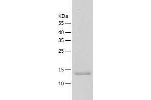 Western Blotting (WB) image for Proteasome (Prosome, Macropain) Assembly Chaperone 3 (PSMG3) (AA 1-122) protein (His tag) (ABIN7288597) (PSMG3 Protein (AA 1-122) (His tag))