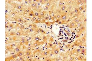 Immunohistochemistry (IHC) image for anti-Indian Hedgehog (IHH) (AA 203-411) antibody (ABIN7156203)
