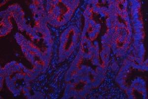 IF analysis of TRMT2B using anti-TRMT2B antibody (ABIN7599456). (TRMT2B Antikörper  (AA 1-504))