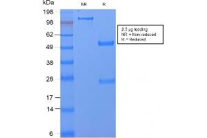 SDS-PAGE Analysis Purified CD59 Rabbit Recombinant Monoclonal Antibody (MACIF/2867R). (Rekombinanter CD59 Antikörper)