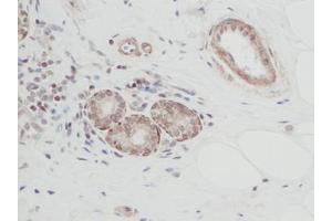 Image no. 1 for anti-Cardiotrophin 1 (CTF1) antibody (ABIN465486) (Cardiotrophin 1 Antikörper)