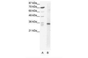 Image no. 1 for anti-Kruppel-Like Factor 3 (Basic) (KLF3) (AA 53-102) antibody (ABIN202293)