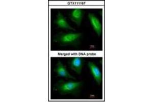 Immunofluorescence analysis of paraformaldehyde-fixed HeLa, using actinin, alpha 2 antibody at 1/200 dilution. (ACTN2 Antikörper)