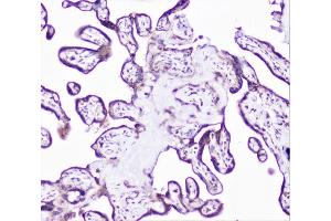 IHC analysis of cortactin using anti-cortactin antibody (ABIN6719306).