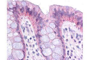 Immunohistochemistry (IHC) image for anti-CCAAT/enhancer Binding Protein (C/EBP), alpha (CEBPA) (Middle Region) antibody (ABIN504380) (CEBPA Antikörper  (Middle Region))