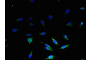 Immunofluorescent analysis of U251 cells using ABIN7159955 at dilution of 1:100 and Alexa Fluor 488-congugated AffiniPure Goat Anti-Rabbit IgG(H+L) (UCP3 Antikörper  (AA 33-76))