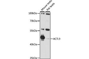 Western blot analysis of extracts of various cell lines, using  antibody (ABIN7265389) at 1:1000 dilution. (ACTL9 Antikörper  (AA 1-416))