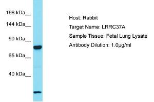 Host: Rabbit Target Name: LRRC37A2 Sample Tissue: Human Fetal Lung Antibody Dilution: 1ug/ml (LRRC37A Antikörper  (C-Term))