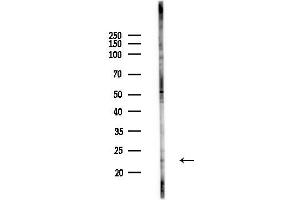 Western blot analysis of lysates from PC12 cells(heat-shock,45 min treatment), using VPS29 Antibody at 1/1000 dilution.