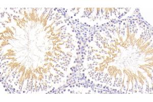 Immunohistochemistry (IHC) image for anti-Nuclear Factor (erythroid-Derived 2)-Like 2 (NFE2L2) (AA 382-604) antibody (ABIN7441676)