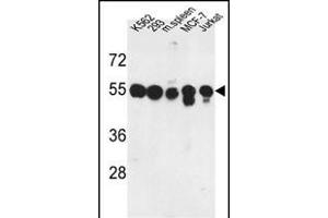 Western blot analysis of M1H Antibody (Center) (ABIN653037 and ABIN2842651) in K562, 293, MCF-7, Jurkat cell line and mouse spleen tissue lysates (35 μg/lane). (PPM1H Antikörper  (AA 235-263))