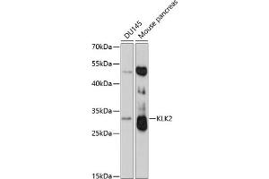 Western blot analysis of extracts of various cell lines, using KLK2 antibody (ABIN3017126, ABIN3017127, ABIN1680612 and ABIN6219970) at 1:3000 dilution.